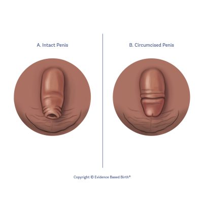 penis circumcisio auto  masaj al testiculelor penisului
